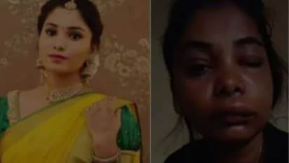 Swathi Sathish : റൂട്ട് കനാല്‍ ശസ്‍ത്രക്രിയയില്‍ പിഴവ്, മുഖം വികൃതമായ അവസ്ഥയില്‍ കന്നഡ നടി