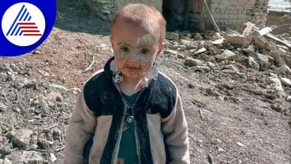 ಅಫ್ಘನ್ ಭೂಕಂಪದಲ್ಲಿ ತನ್ನವರನ್ನೆಲ್ಲಾ ಕಳೆದುಕೊಂಡ 3 ವರ್ಷದ ಮಗುವಿಗೆ ಮರುಗಿದ ಜನ!