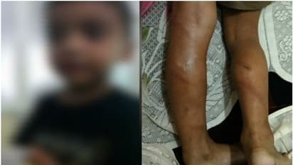 ഇംഗ്ലീഷ് അക്ഷരങ്ങൾ പറഞ്ഞില്ല; എറണാകുളത്ത് നാല് വയസുകാരനെ ക്രൂരമായി മര്ദ്ദിച്ച് ട്യൂഷൻ അധ്യാപകന്