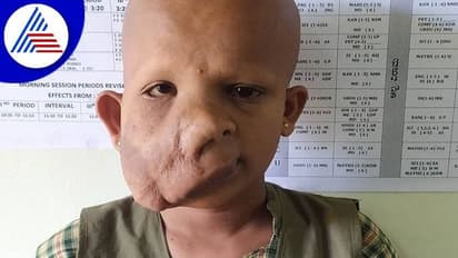 ಬಾಲಕಿ ದೇವಮ್ಮಳ ಚಿಕಿತ್ಸೆಗೆ ಬೇಕಿದೆ ನೆರವಿನ ಹಸ್ತ: ದಾನಿಗಳ ಮೊರೆ ಹೋದ ಬಡ ಕುಟುಂಬ