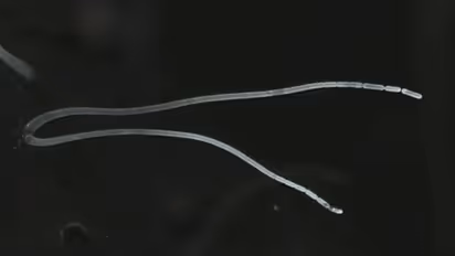 वैज्ञानिकों ने खोजा दुनिया का सबसे बड़ा बैक्टीरिया, नंगी आखों से भी आता है नजर