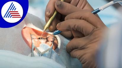 ಆಪರೇಷನ್‌ ಮಾಡಲು ಹೋಗಿ ಇದ್ದೊಂದು ಕಣ್ಣನೂ ತೆಗೆದ ವೈದ್ಯ 