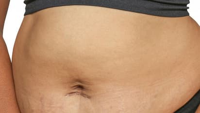 డెలివరీ తరువాత వచ్చే పొట్ట, బరువును తగ్గించే సూపర్ హెల్తీ టిప్స్!