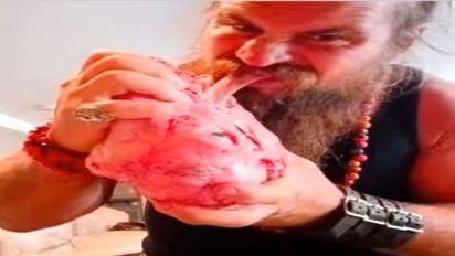 दूध, अंडा, मांस सब कुछ कच्चा खाता है यह शख्स, बताया ऐसे खाने से क्या होता है उसके साथ