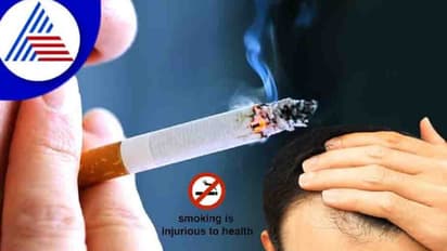 ಸ್ಮೋಕ್ ಮಾಡ್ಬೇಡಿ, ಕೂದಲು ಉದುರುತ್ತೆ ! ಮಧ್ಯೆಯಿರೋ ಲಿಂಕ್ ಏನು ?