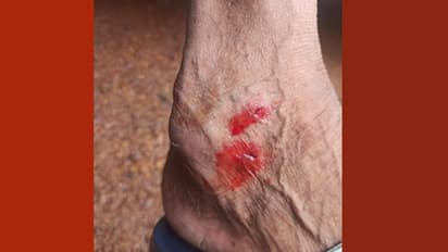 ചാലിയാറിൽ കുളിക്കാനിറങ്ങിയ രണ്ടുപേരെ നീർനായ കടിച്ചു