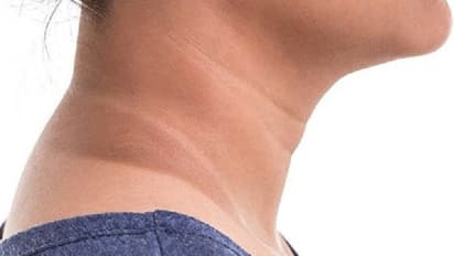 സ്ത്രീകള് അറിയാൻ; തൊലിയില് കറുപ്പ് നിറം പടരുന്നതും ശരീരത്തില് രോമവളര്ച്ച കൂടുന്നതും...