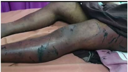 അട്ടപ്പാടിയിൽ 10 അംഗ സംഘത്തിന്റെ അടിയേറ്റ് ചികിത്സയിലായിരുന്ന കണ്ണൂർ സ്വദേശി വിനായകനും മരിച്ചു