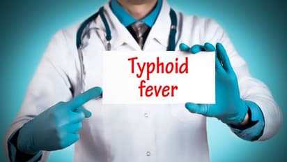 Typhoid Fever :  ടൈഫോയ്ഡ് പനി; ഇക്കാര്യങ്ങൾ ശ്രദ്ധിക്കുക