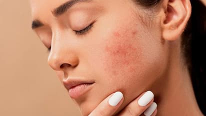 Skin Disease : നിസാരമെന്ന് തോന്നും, പക്ഷേ 'സ്കിൻ' രോഗങ്ങൾ അടക്കം പലതിലേക്കും നയിക്കുന്നൊരു പ്രശ്നം...