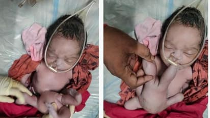 ನಾಲ್ಕು ಕೈ  ಕಾಲುಗಳನ್ನು ಹೊಂದಿದ ವಿಚಿತ್ರ ಮಗು ಜನನ : ದೇವಿಯ ಅವತಾರವೆಂದ ಜನ