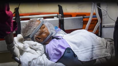 लालू प्रसाद यादव हेल्थ अपडेट: सीढ़ी पर गिरने से 3 जगह फ्रैक्चर, दवाओं का ओवरडोज-देशभर में हो रही दुआ