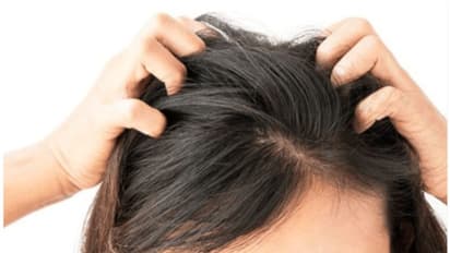 പേൻശല്യം ഫലപ്രദമായി പരിഹരിക്കാൻ ചെയ്യേണ്ട കാര്യങ്ങള്‍...