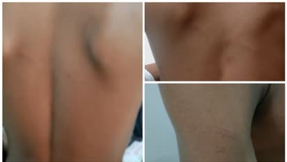 ഡെസ്കില്‍ താളമിട്ടു; തൃശ്ശൂരില്‍ സർക്കാർ പ്രീമെട്രിക് ഹോസ്റ്റലിൽ ആദിവാസി ബാലന് മർദ്ദനം