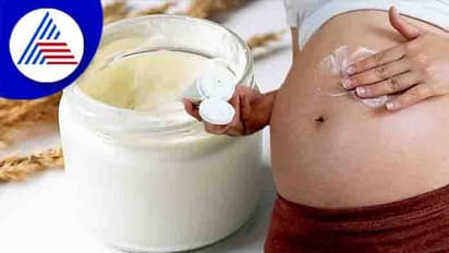 ಸ್ಟ್ರೆಚ್ ಮಾರ್ಕ್ ಬಗ್ಗೆ ಚಿಂತೆ ಬೇಡ, ಕೋಕೋ ಬಟರ್ ಬಳಸಿ ನೋಡಿ