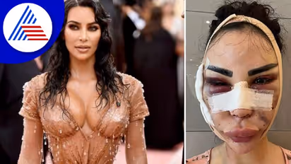 Kim kardashian: நடிகையை போல் மாற 40 சர்ஜரிகள்..செலவு மட்டும் ரூ.4.7 கோடியாம்...இருந்தும் இப்படி ஒரு நிலைமையா? 