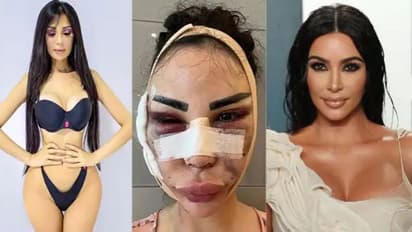 കിം കര്ദാഷിയാനെപ്പോലാവാന് 4.7 കോടി മുടക്കി 40 ശസ്ത്രക്രിയ, എന്നിട്ടും അവളിപ്പോള്...