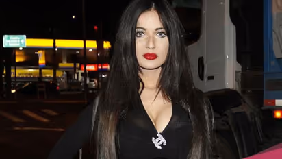 किम कर्दाशियन जैसी दिखने मॉडल ने खर्च किए करीब 5 करोड़ रु., 40+ सर्जरी के बाद अब असली लुक पाने झेल रही दर्द