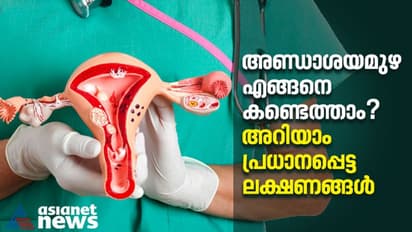 Ovarian cancer : അണ്ഡാശയമുഴ ; ഈ ലക്ഷണങ്ങൾ അവഗണിക്കരുത്
