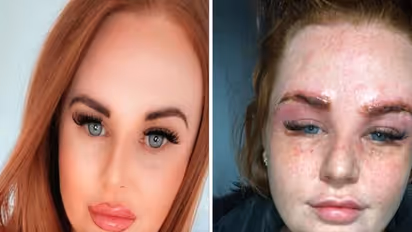 ब्यूटी पार्लर में आइब्रो बनवाने गई महिला की हुई ऐसी हालत की पहचान पाना तक हो रहा है मुश्किल