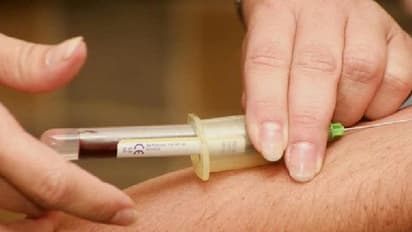 Covid 19 : കൊവിഡ് 19; 'രക്തം കട്ട പിടിച്ചുകിടിക്കുന്നത് പരിശോധിക്കാൻ എളുപ്പമാര്‍ഗം'