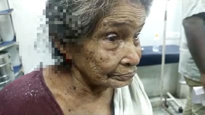90 വയസുകാരിയോട് കൊടും ക്രൂരത; കമ്മൽ പറിച്ചെടുക്കുന്നതിനിടെ ചെവിയറ്റു