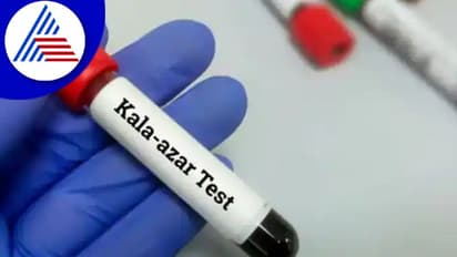 Black Fever: ಎಚ್ಚರ..! ಹರಡುತ್ತಿದೆ ಮಾರಣಾಂತಿಕ ಕಪ್ಪು ಜ್ವರ