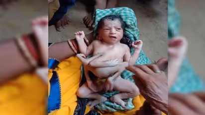 उन्नाव में लिया अनोखे बच्चे ने जन्म, भागवान से की जा रही तुलना, देखने के लिए लगा जमावड़ा