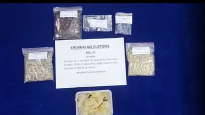 வயிற்றில் வைத்து ரத்தின கற்கள் கடத்தல்.. சென்னையில் சிக்கிய முக்கிய பிரமுகர்.. கசிந்த தகவல்..