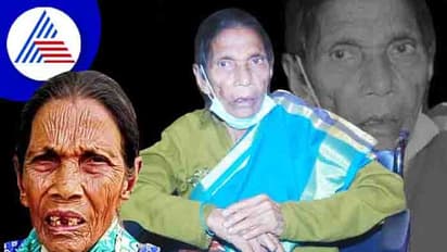 ಕಳಚಿತು ಪಾರಂಪರಿಕ ವೈದ್ಯ ಪದ್ದತಿಯ ಕೊಂಡಿ: 10 ಸಾವಿರಕ್ಕೂ ಹೆಚ್ಚು ಹೆರಿಗೆ ಮಾಡಿಸಿದ್ದ ಸುಲ್ತಾನಮ್ಮ ಇನ್ನಿಲ್ಲ