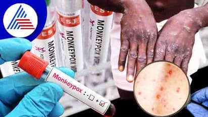 ಸಾಕುನಾಯಿಗೂ ಮಂಕಿಪಾಕ್ಸ್ ವೈರಸ್‌ ಹರಡುವ ಸಾಧ್ಯತೆ: ವೈದ್ಯರ ವರದಿ