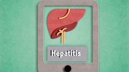 World Hepatitis Day 2022: What is Hepatitis? Know its types, symptoms and causes
