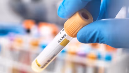  മേമുണ്ട ഹയർ സെക്കന്ററി സ്കൂളിലെ 23വിദ്യാർത്ഥികൾക്ക് മഞ്ഞപ്പിത്തം; 3 കടകൾ അടപ്പിച്ചു, വെള്ളം പരിശോധിക്കും