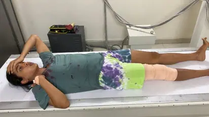 ಬೆಂಗಳೂರು: ಶೂಟಿಂಗ್ ವೇಳೆ ನಟಿ ಸಂಯುಕ್ತ ಹೆಗ್ಡೆಗೆ ಅಪಘಾತ