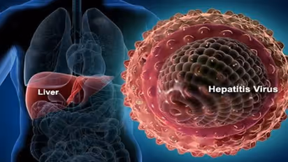 World hepatitis day: कितनी खतरनाक है यह बीमारी, क्या है इसके लक्षण, जानें कब हो सकती है जानलेवा