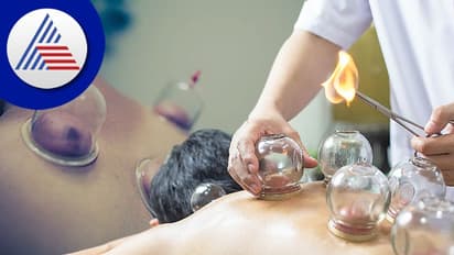 ನೋವಿಗೆ ಪರಿಹಾರ ನೀಡುತ್ತೆ ಈ Cupping Therapy!