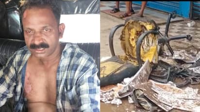 ജോലി ചെയ്യുന്ന മെഡിക്കൽ ഷോപ്പിലെത്തി യുവതിയെ ഭര്ത്താവ് മണ്ണെണ്ണയൊഴിച്ച് തീകൊളുത്തി