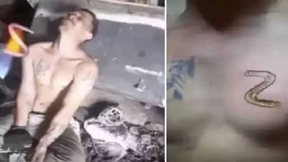 പുടിനോടുള്ള ആരാധന, ചുട്ടുപഴുത്ത ഇരുമ്പ് ദണ്ഡുകൊണ്ട് നെഞ്ചിൽ 'Z' വരച്ച് യുവാവ്