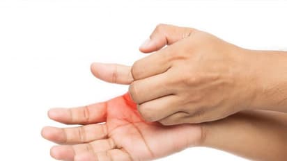 Itchy Hands and Feet :  രാത്രിയിൽ കയ്യിലും കാലിലും കഠിനമായ ചൊറിച്ചിൽ ഉണ്ടാകാറുണ്ടോ? കാരണം 