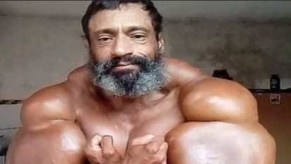 Hulk बनने की सनक में करता रहा बेतुके काम.. बेहद बुरा हुआ अंजाम, 10 फोटो में देखिए कैसी बना ली थी बॉडी 