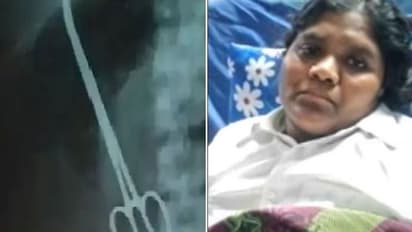 12 ஆண்டுகளாக பெண்ணின் வயிற்றில் கத்தரிக்கோல்.. 10 லட்சம் இழப்பீடு கொடுக்க உத்தரவு !