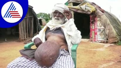 Gadag: ಅಸಾಮಾನ್ಯ ಹೊಟ್ಟೆ, ಅಜ್ಜನ ನರಕಯಾತನೆ: ವೃದ್ಧನಿಗೆ ಬೇಕಿದೆ ಸಹಾಯ