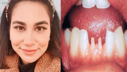 खूबसूरत स्माइल पाने की चाहत में महिला की छीन गई मुस्कान, डेंटिस्ट ने किया कुछ ऐसा हाल