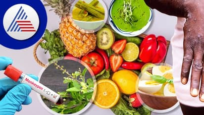 ಮಂಕಿಪಾಕ್ಸ್ ಸೋಂಕಿನಿಂದ ಬೇಗ ಚೇತರಿಸಿಕೊಳ್ಳಲು ಇಂಥಾ ಆಹಾರ ತಿನ್ನಿ