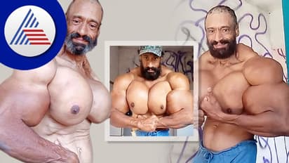 Brazilian Hulk: ಇಂಜೆಕ್ಶನ್ ಬಳಸಿ ಬೈಸೆಪ್ಸ್ ಬೆಳೆಸಿದ್ದ ಬಾಡಿ ಬಿಲ್ಡರ್ ಸಾವು