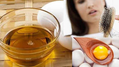 Health Tips : ಕೊಲೆಸ್ಟ್ರಾಲ್ ಹೆಚ್ಚಾಗ್ತಿದ್ರೆ ಆಹಾರದಲ್ಲಿ ಈ ಎಣ್ಣೆ ಬಳಸಿ