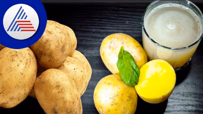 Health Tips : ಆಲೂಗಡ್ಡೆ ಜ್ಯೂಸ್ ಕುಡಿದು ಆರೋಗ್ಯ ಕಾಪಾಡ್ಕೊಳ್ಳಿ