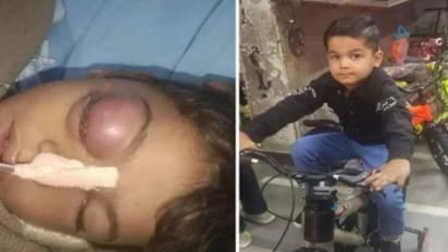 राजस्थान में दर्दनाक मामला: दलित छात्र ने स्कूल में मटकी से पानी पिया तो टीचर बना हैवान, पिटाई से मौत