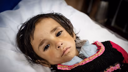 നാടെങ്ങും പട്ടിണിയും ദാരിദ്ര്യവും, താലിബാന് വന്നശേഷം അഫ്ഗാനില് കുട്ടികള് മരിച്ചുവീഴുന്നു!