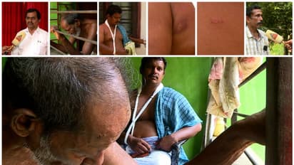 അയർകുന്നത്ത് തൊഴിലാളിയെ മർദിച്ച സംഭവം:പൊലീസിലെ ക്രിമിനലുകളെ നിലക്ക് നിർത്തണം-സിപിഐ,മർദനമേറ്റതിന് തെളിവുണ്ട്